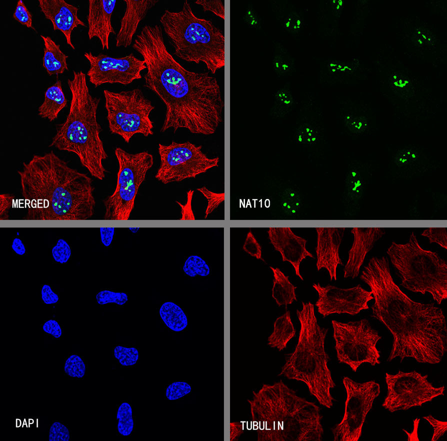 NAT10 Recombinant Rabbit mAb (S-2547-125)