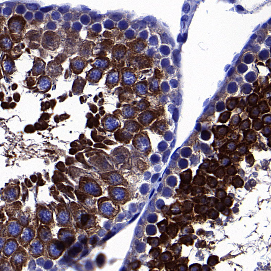 GFPT1 Recombinant Rabbit mAb (S-4752-19)