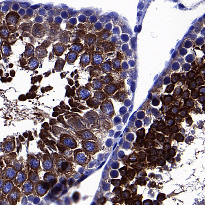 GFPT1 Recombinant Rabbit mAb (S-4752-19)