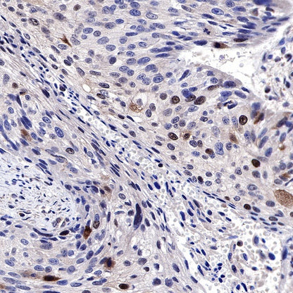 Phospho-IκBα (Ser36) Recombinant Rabbit mAb (S-R102)