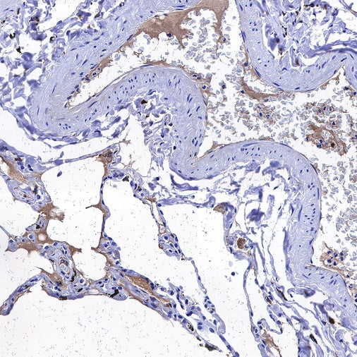 C1q Recombinant Rabbit mAb (S-472-105)