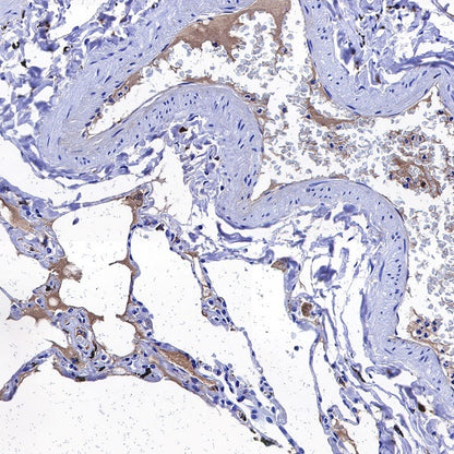 C1q Recombinant Rabbit mAb (S-472-105)