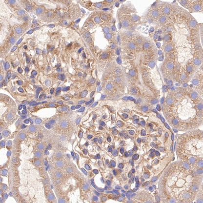 Beclin-1 Recombinant Rabbit mAb (S-761-15)