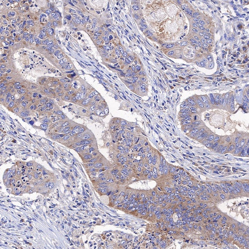 KRAS Recombinant Rabbit mAb (S-443-69)