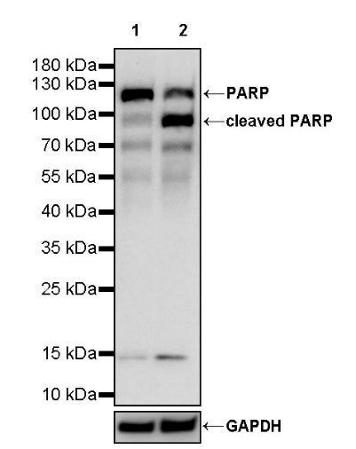 PARP Recombinant Rabbit mAb (S-4303)