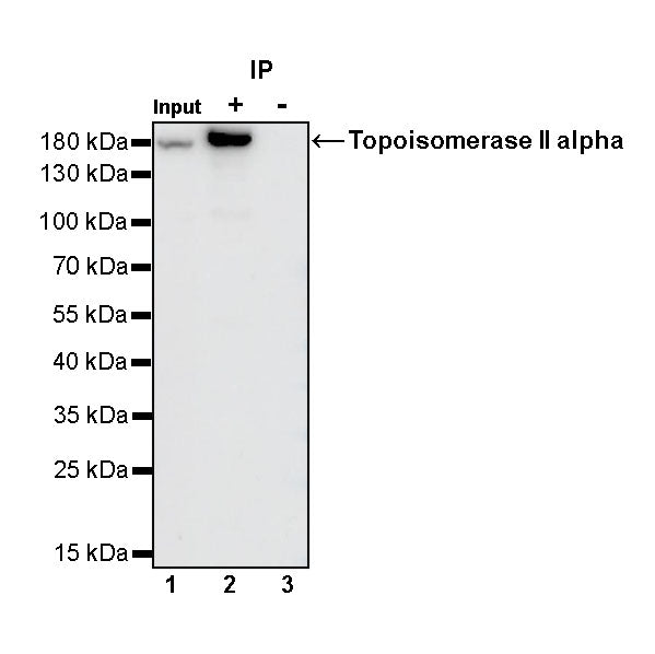 Topoisomerase II alpha Recombinant Rabbit mAb (S-513-7)