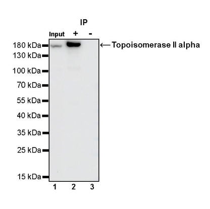 Topoisomerase II alpha Recombinant Rabbit mAb (S-513-7)