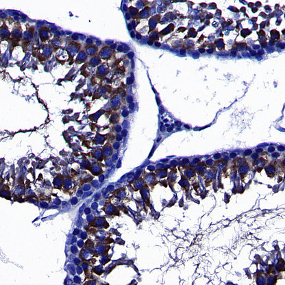 Upf1 Rabbit Polyclonal Antibody
