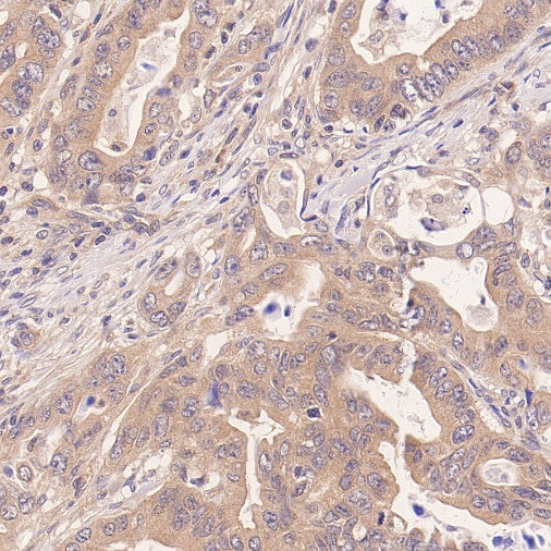 IFT88 Recombinant Rabbit mAb (S-2187-107)