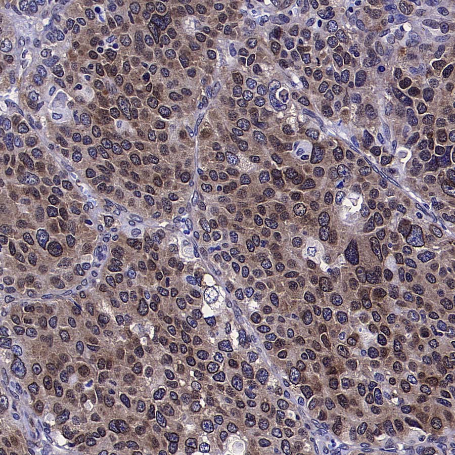 eIF6 Recombinant Rabbit mAb (S-4171-13)