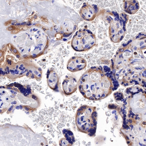 PI3 Kinase p85α Recombinant Rabbit mAb (S-328-24)