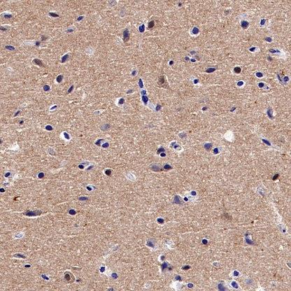 Pan Trk Recombinant Rabbit mAb (SDT-400-39)