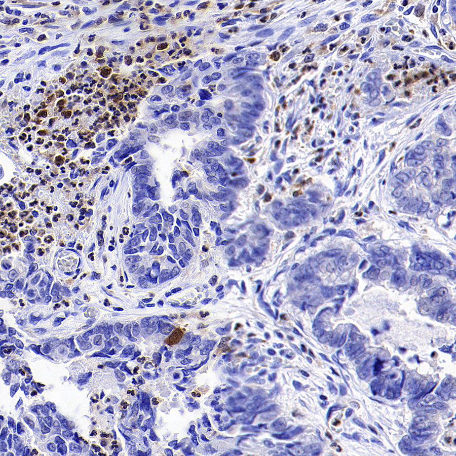 Syk Recombinant Rabbit mAb (S-4400-11)