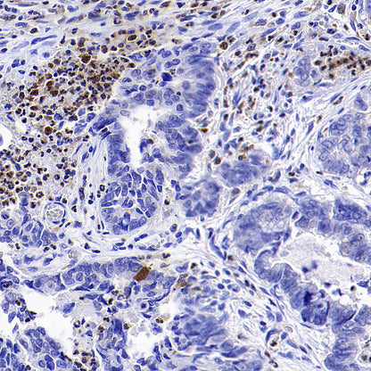 Syk Recombinant Rabbit mAb (S-4400-11)