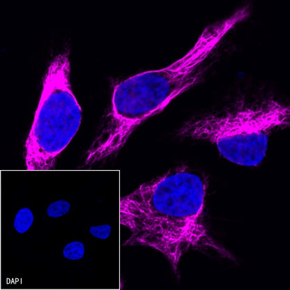 Vimentin Recombinant Rabbit mAb (Alexa Fluor® 647 Conjugate) (S-029-20)