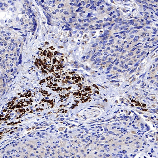 CXCR3 Recombinant Rabbit mAb (S-377-8)
