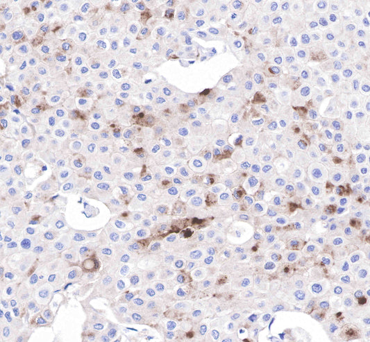 S-RMab® GCDFP-15 Recombinant Rabbit mAb (SDT-010-579)