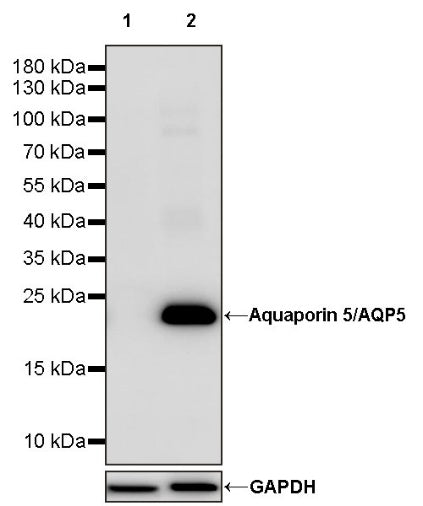 Aquaporin 5/AQP5 Recombinant Rabbit mAb (S-1622-5)