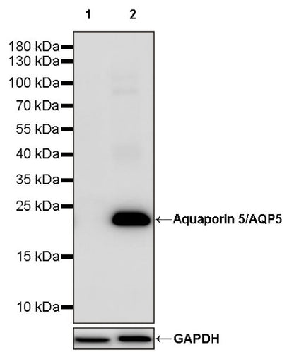 Aquaporin 5/AQP5 Recombinant Rabbit mAb (S-1622-5)