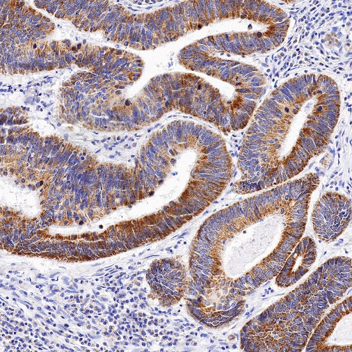 TFAM Recombinant Rabbit mAb (S-1018-53)