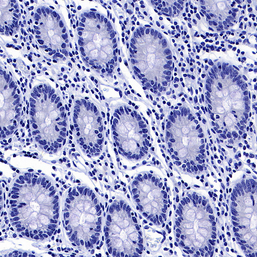 GABRA1 Recombinant Rabbit mAb (S-3254-10)