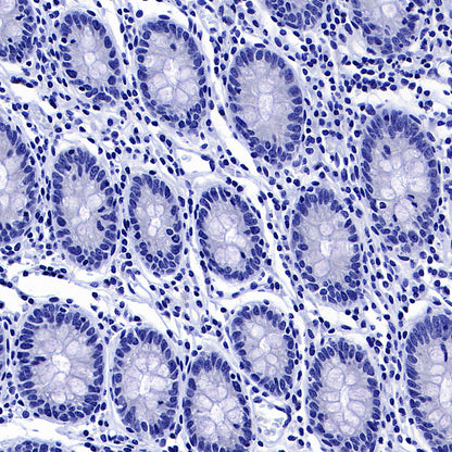 GABRA1 Recombinant Rabbit mAb (S-3254-10)