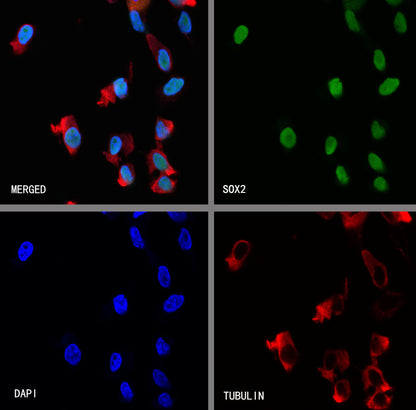 SOX2 Recombinant Rabbit mAb (S-5000)