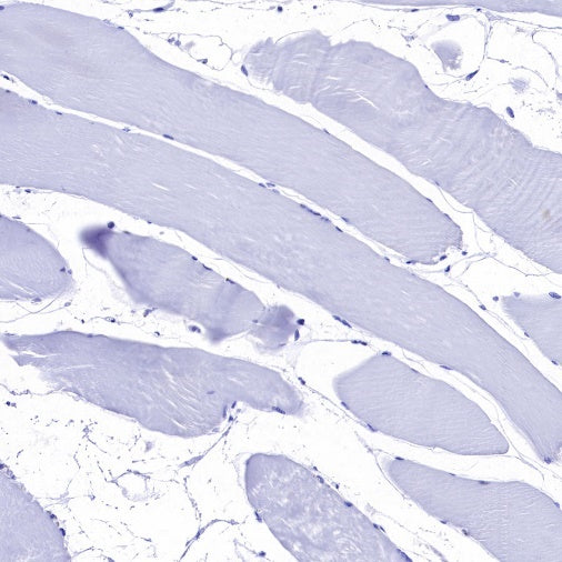 IκBα Recombinant Rabbit mAb (SDT-457-9)