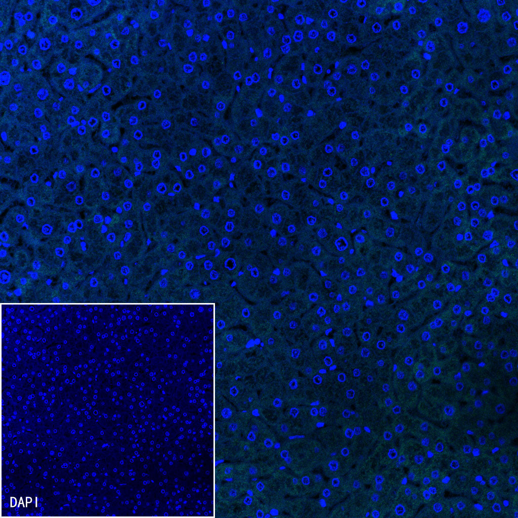 Glypican-3 Recombinant Rabbit mAb,PBS Only (SDT-R032)
