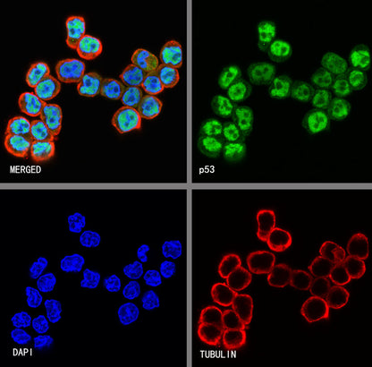 p53 Recombinant Rabbit mAb (SDT-100-72)