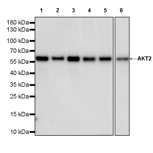 AKT2 Recombinant Rabbit mAb (S-2617-6)