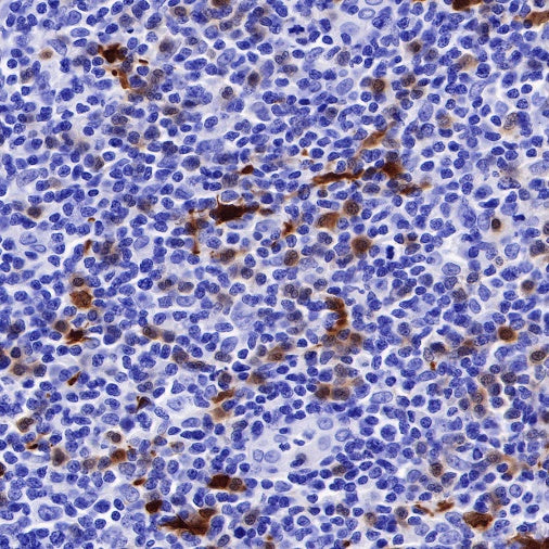 IDO1/Indoleamine 2,3-dioxygenase Recombinant Rabbit mAb (S-R225)