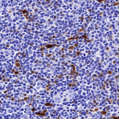 IDO1/Indoleamine 2,3-dioxygenase Recombinant Rabbit mAb (S-R225)
