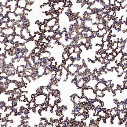 Angiotensin Converting Enzyme 1 Recombinant Rabbit mAb (SDT-2662-122)