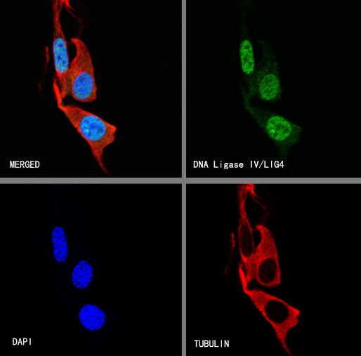 DNA Ligase IV/LIG4 Recombinant Rabbit mAb (S-2237-118)