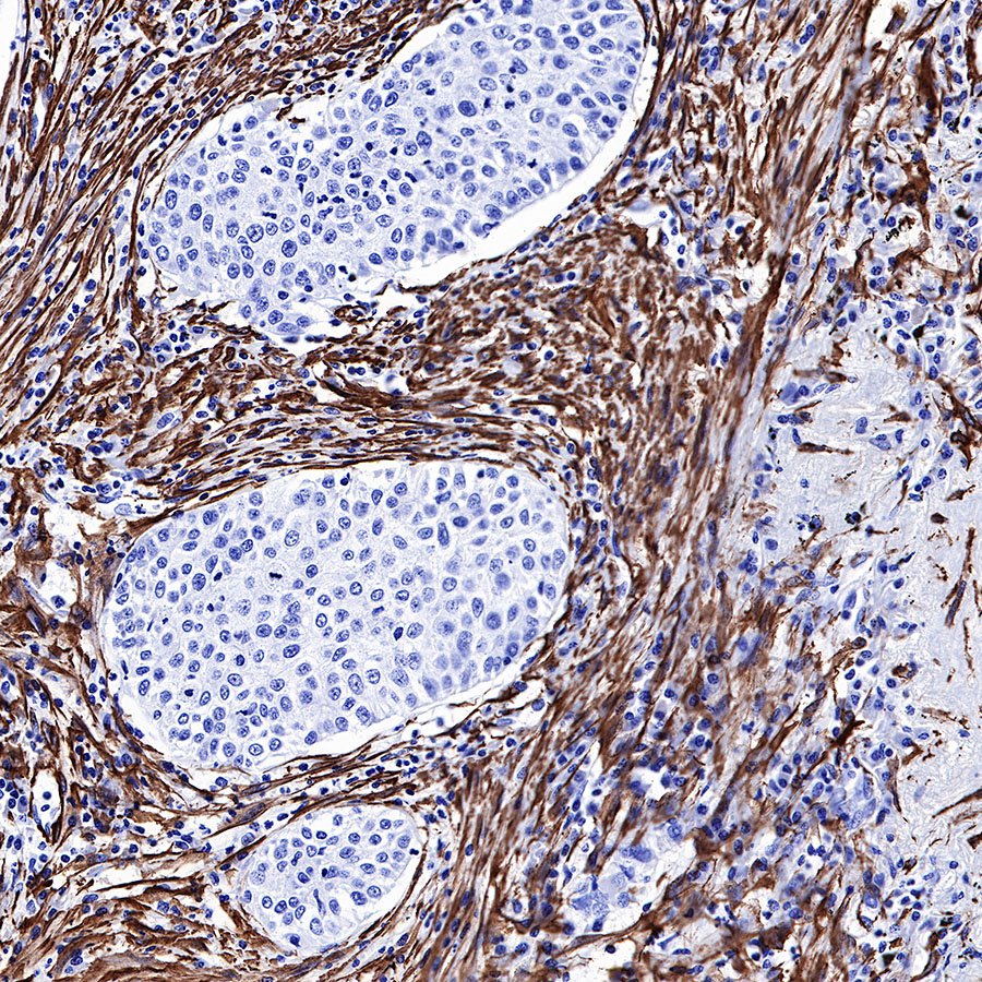 alpha smooth muscle Actin (SMA) Recombinant Rabbit mAb,PBS Only (SDT-132-63)