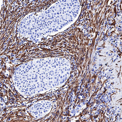 alpha smooth muscle Actin (SMA) Recombinant Rabbit mAb,PBS Only (SDT-132-63)