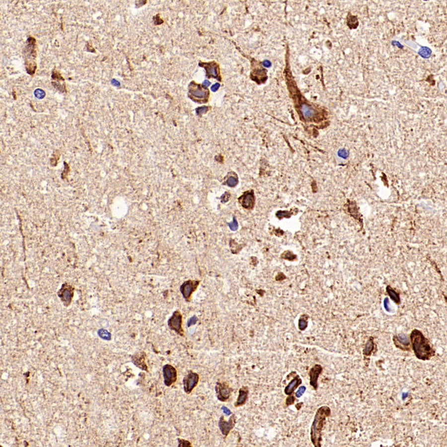 CDS1 Recombinant Rabbit mAb (S-3671-30)