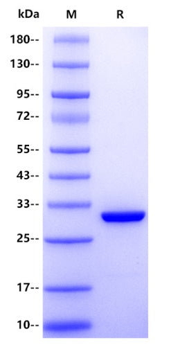 Human Stratifin/14-3-3 sigma Protein, His Tag