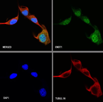 CNOT1 Recombinant Rabbit mAb (S-2273-65)