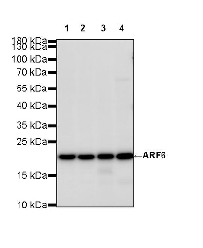 ARF6 Recombinant Rabbit mAb (S-4283-62)