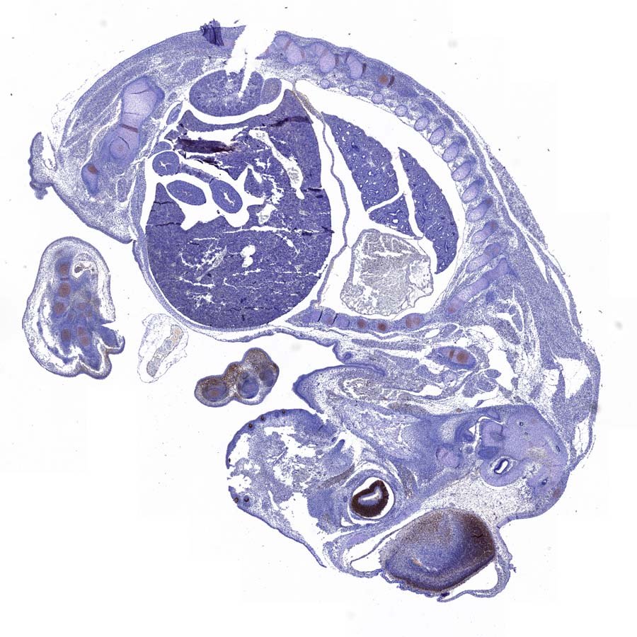 Lhx2/LH2 Recombinant Rabbit mAb (S-3867-28)