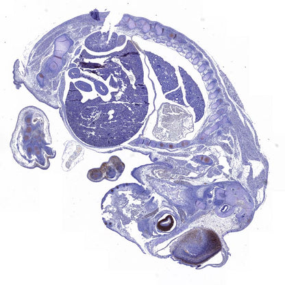 Lhx2/LH2 Recombinant Rabbit mAb (S-3867-28)
