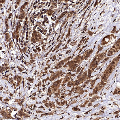 cIAP2 Recombinant Rabbit mAb (S-2483-8)