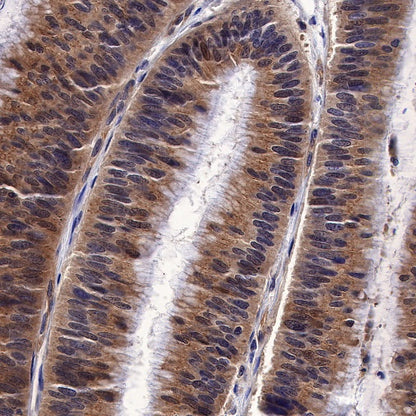 ST13 Recombinant Rabbit mAb (S-661-38)
