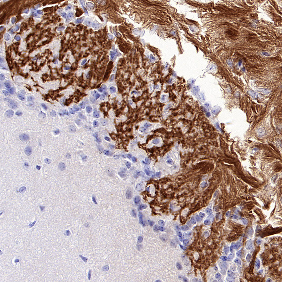 Olfactory Marker/OMP Recombinant Rabbit mAb (S-3513-32)