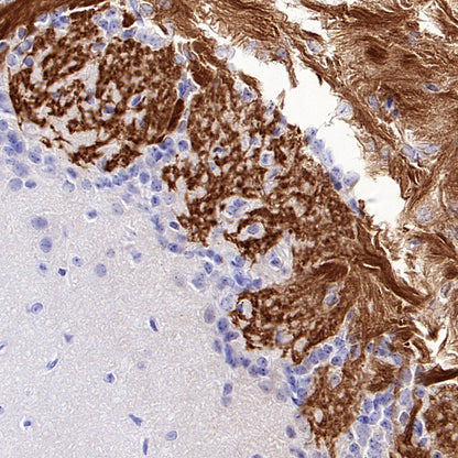 Olfactory Marker/OMP Recombinant Rabbit mAb (S-3513-32)