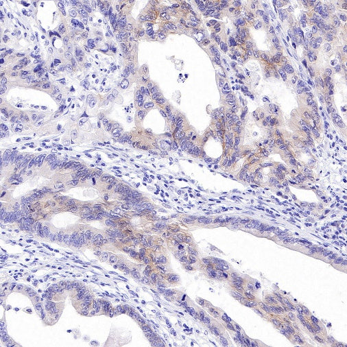 S-RMab® ErbB3 Recombinant Rabbit mAb (SDT-991-10)