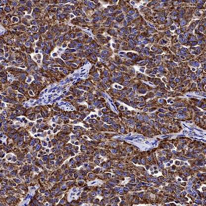 TOM20 Recombinant Rabbit mAb (SDT-2553-11)