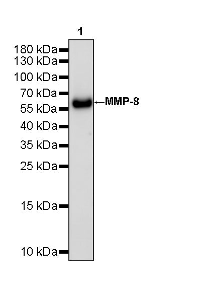 MMP-8 Recombinant Rabbit mAb (S-5674)